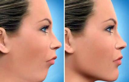 جراحی فک و دهان و صورت چگونه انجام میشود