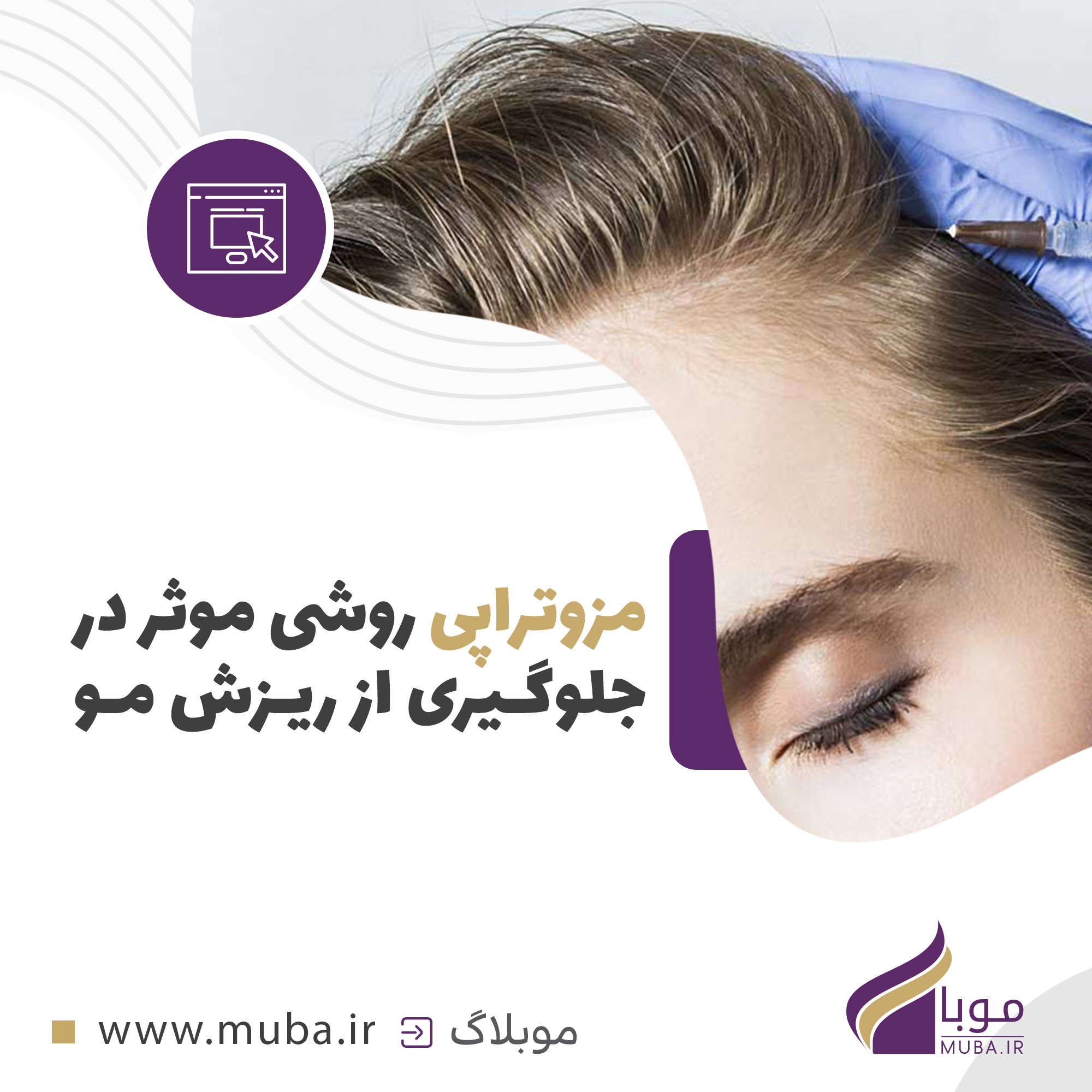 مزوتراپی روشی موثر در جلوگیری از ریزش مو