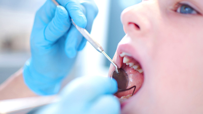 عفونت دندان درمان، رفع عفونت دندان