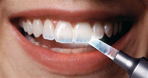 آنچه برای محافظت از مینای دندان خود لازم است بدانید