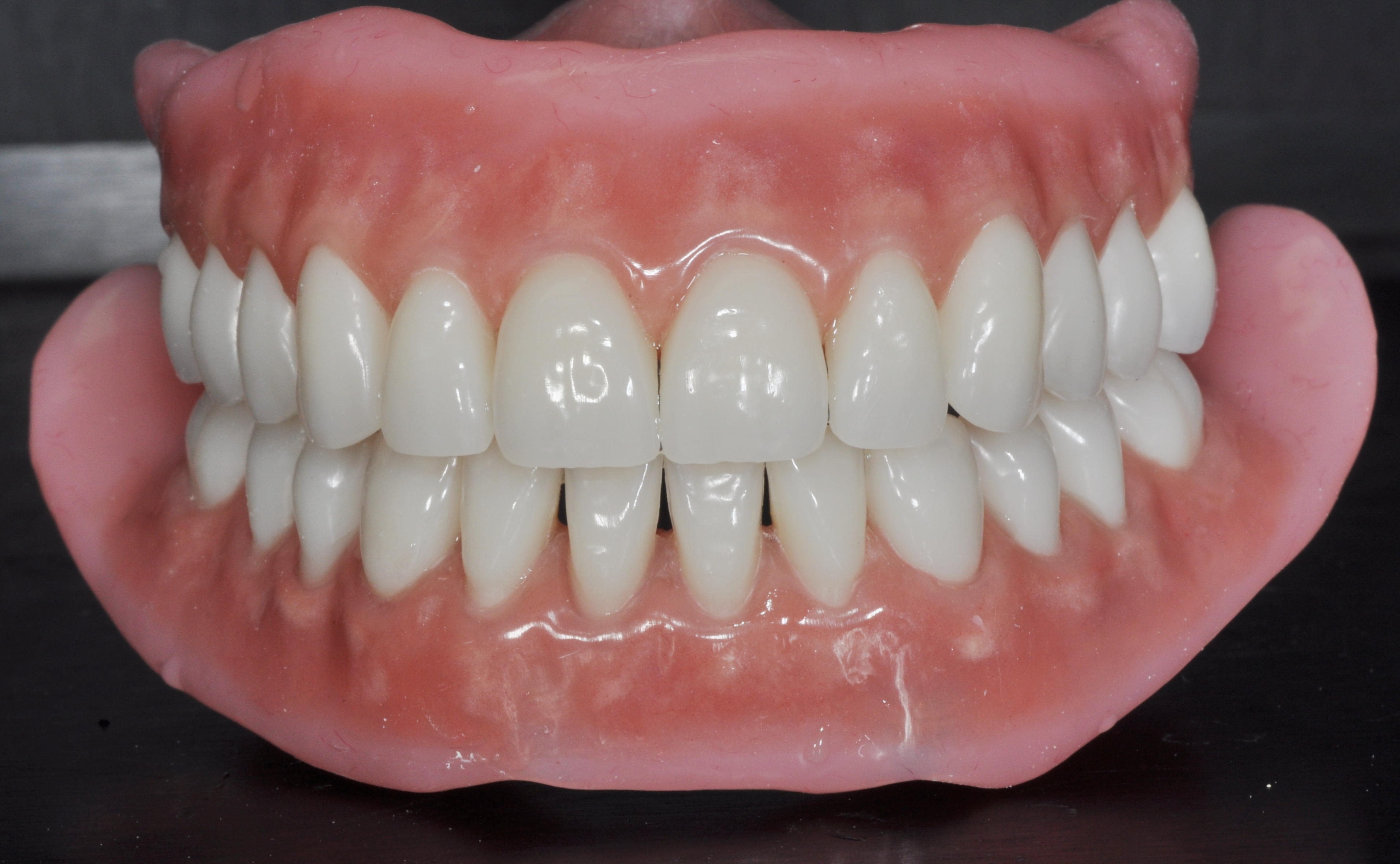 توجه کسانی که برای اولین بار از دندان مصنوعی کامل استفاده می کنند