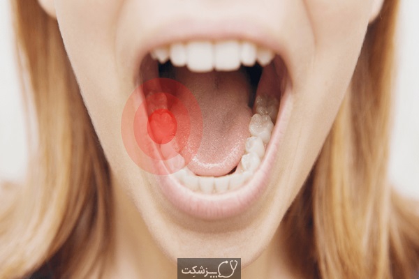 درد دندان را چگونه در خانه درمان کنیم؟