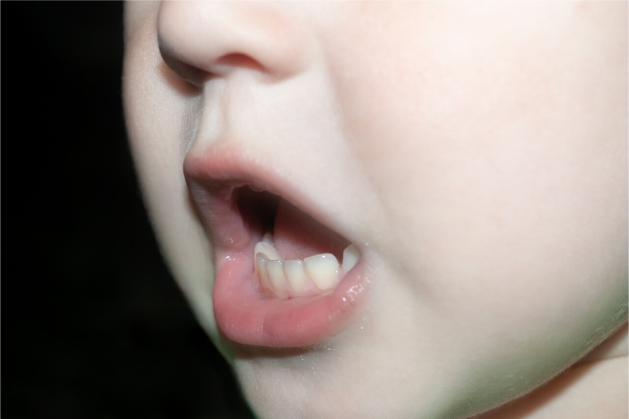 علائم عفونت دندان که به بدن شما سرایت می کند چیست؟