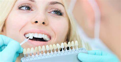 دندانپزشکی زیبایی