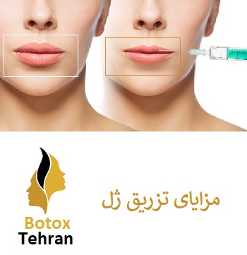 کاربرد های تزریق ژل در تهران