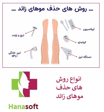 روش های حذف موهای زائد در اصفهان