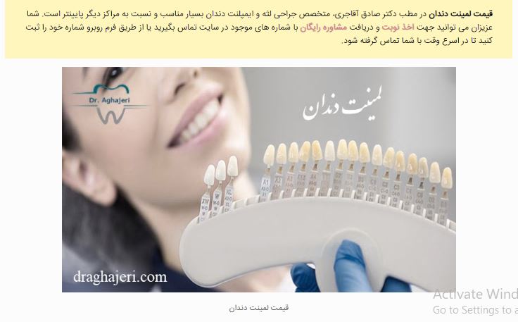 انجام لمینت دندان در تهران