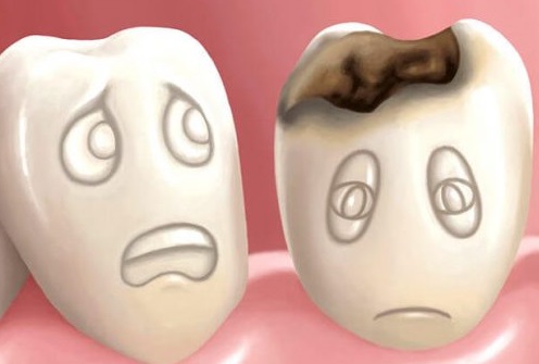 روش جدیدی برای درمان التهاب شدید دندان