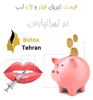 قیمت تزریق فیلر و ژل در تهرانپارس