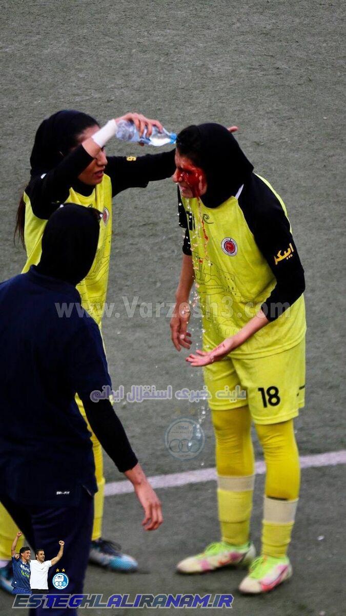 عکس| تصویری وحشتناک از فوتبال زنان ایران/ صورت خونین یک بازیکن و جراحی وسط بازی!