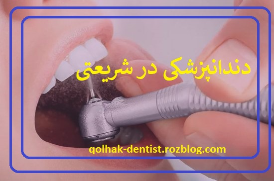 معرفی بهترین دندانپزشکی در خیابان شریعتی شمال تهران