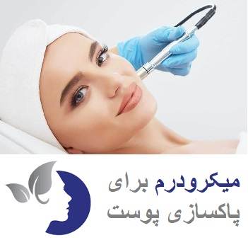 میکرودرم ، بهترین روش پاکسازی پوست در تهران 