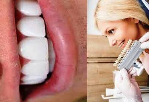ایا انتخاب دندانپزشکی ماهر مهم است یا خیر