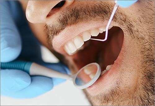 چه عواملی روی قیمت لمینت دندان تاثیر گذار است