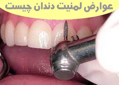 عوارض لمنیت دندان چیست 