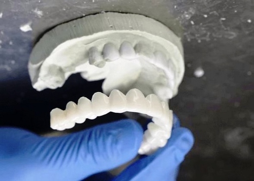 جایگزین‌ برای اسنپ اسمایل دندان چیست 