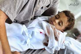 بیش از ۷۰۰ کودک در نوار غزه قربانی شده‌اند | خبرگزاری صدا و سیما