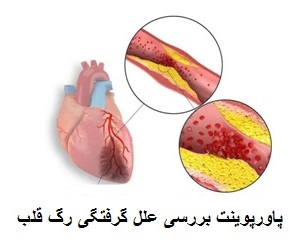 بررسی علل گرفتگی رگ قلب 30 اسلاید ppt