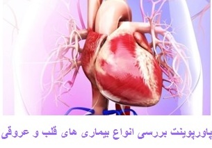 خرید و دانلود ppt بررسی انواع بیماری های قلب و عروقی 25 اسلاید