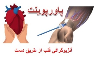 دریافت ppt چگونگی آنژیوگرافی قلب از طریق دست 24 اسلاید ppt
