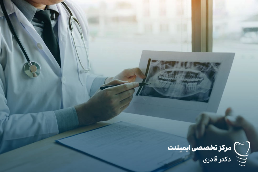 کاشت ایمپلنت بصورت اقساطی در کلینیک دکتر قادری 