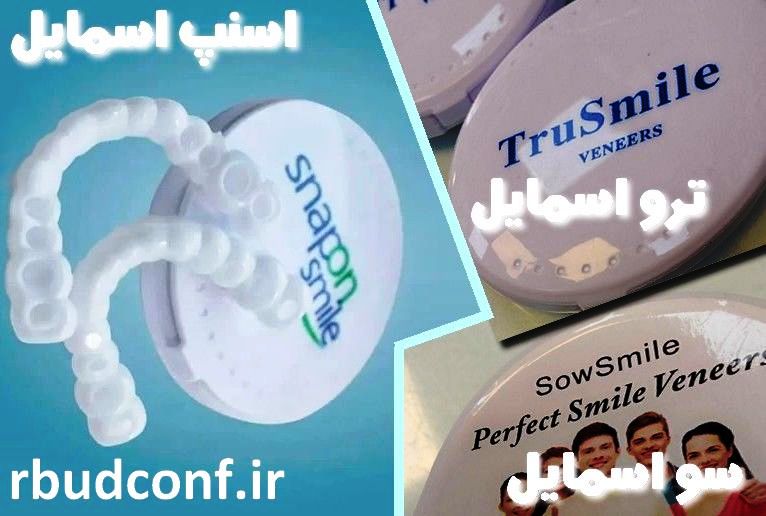 انواع  مختلف لمینت متحرک دندان آماده در ایران چند دسته هستند