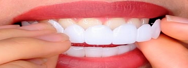 مراحل قالب گیری لمینت متحرک دندان از صفر تا صد 