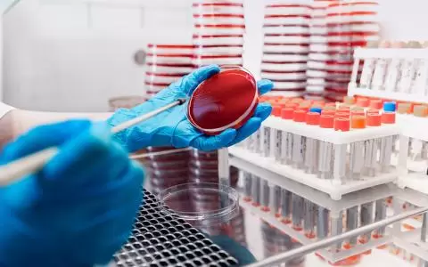 آزمایش کشت خون یا Blood Culture (B/C)