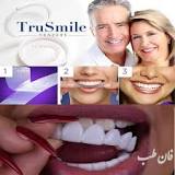 ‫لمینت متحرک ترو اسمایل+هدیه نوار چسب سفید کننده دندان - فان طب‬‎