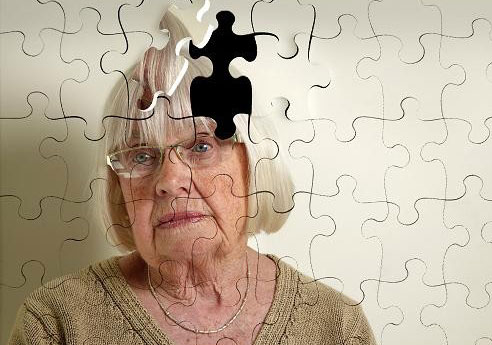 شش راه برای فرار از آلزایمر